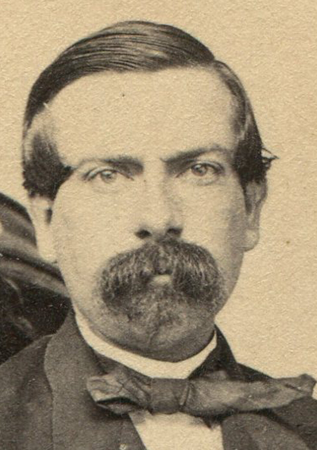 ANGRY MAN WITH IMPRESSIVE FACIAL HAIR. CDV, RARE MAKER MARK. BOSTON.