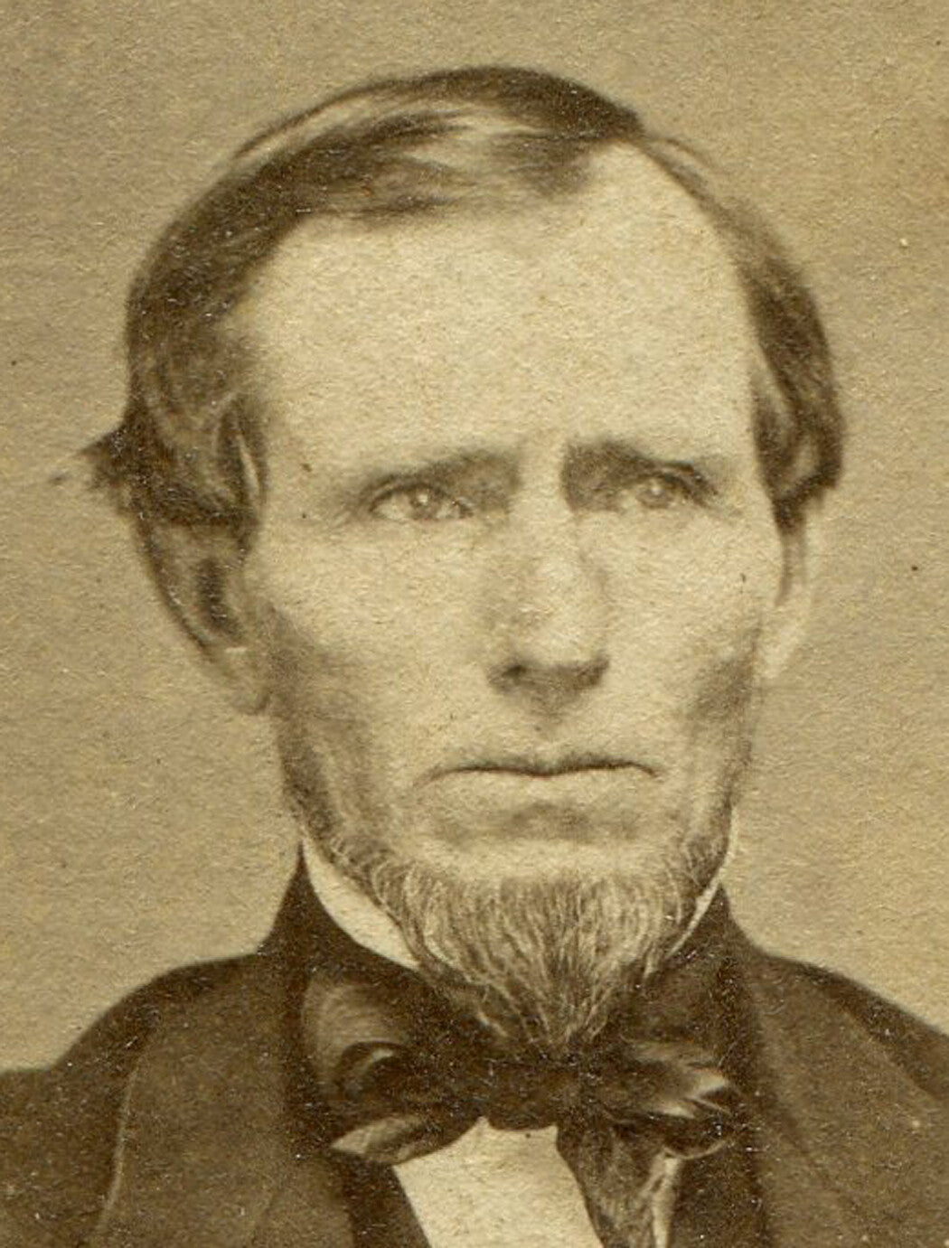 MAN HOLDING BACK TEARS. CDV.