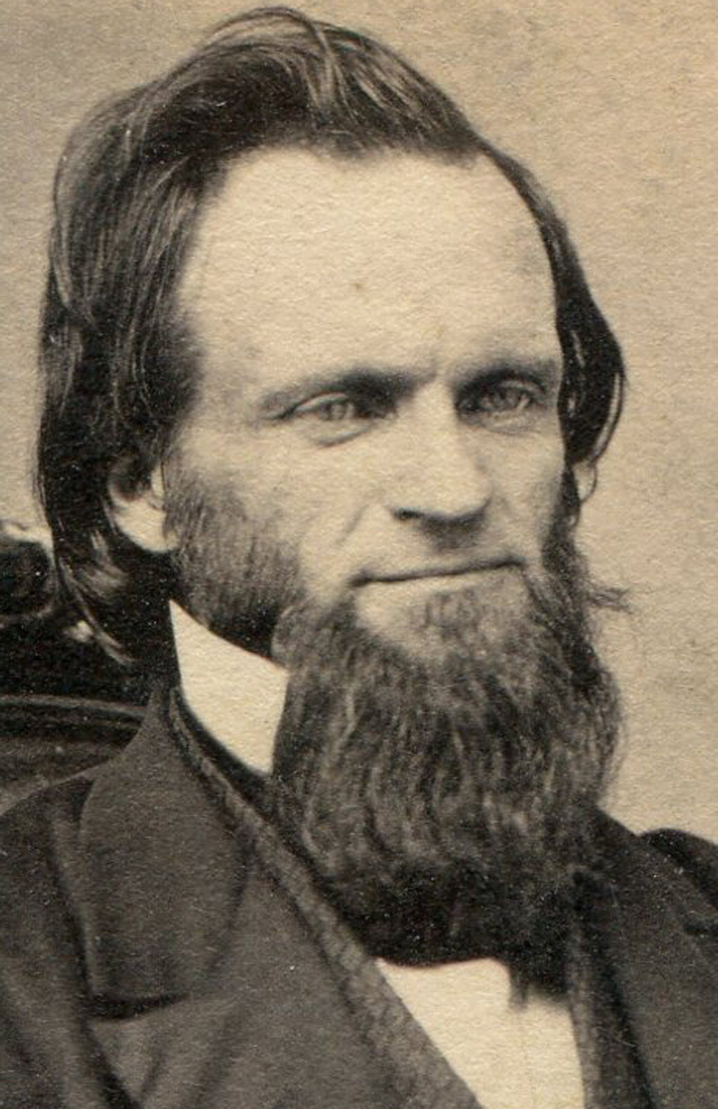 MAN WITH STRANGE UNIQUE BEARD. ITS WEIRD. CDV. FT. EDWARD, N.Y.