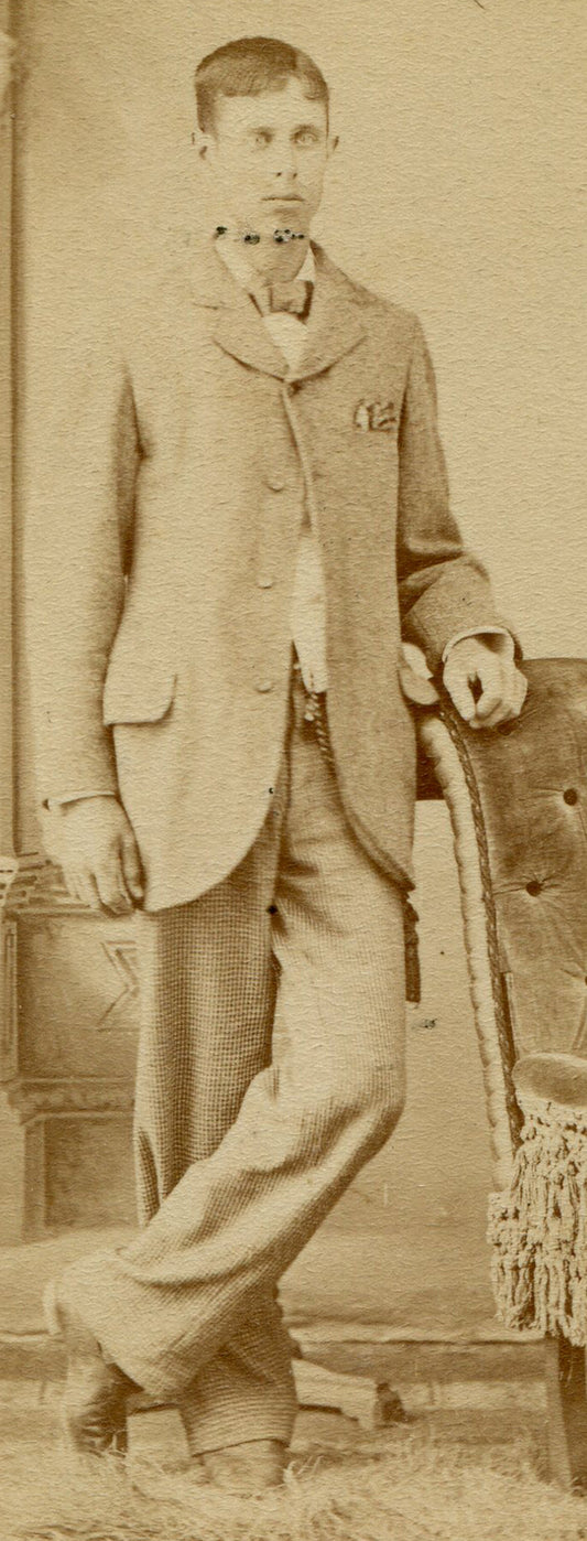 TALL THIN MAN WITH BUG EYES. CDV.