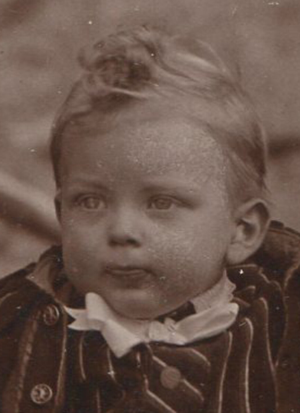 TODDLER POSED IN STRIPED DRESS. CABINET CARD.