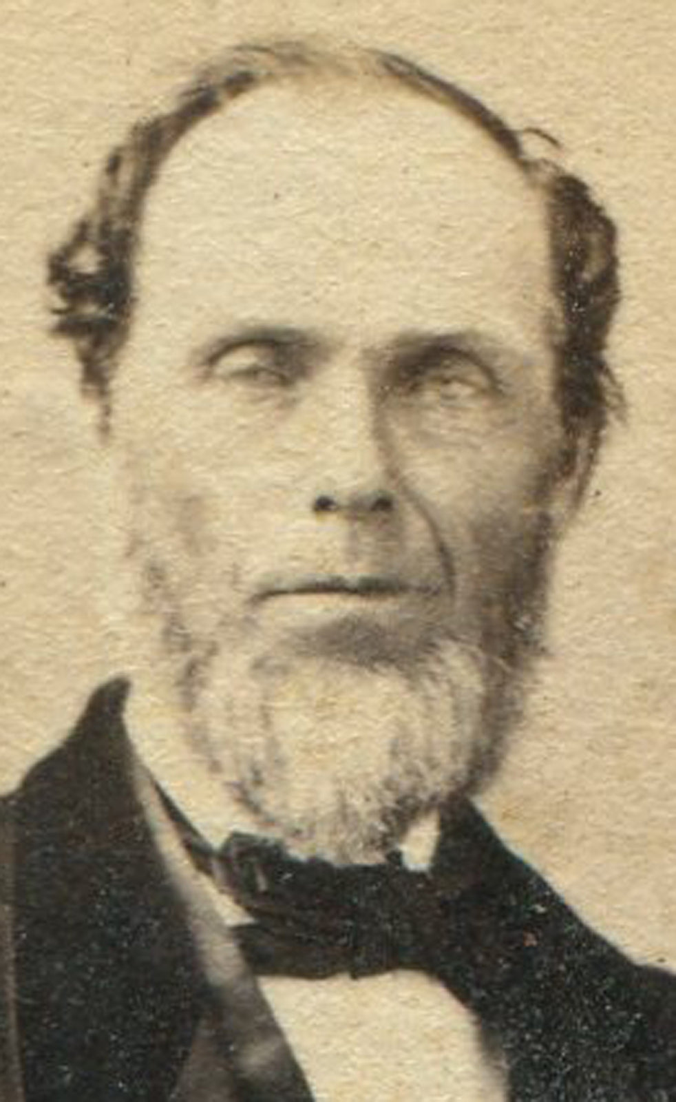 CIVIL WAR ERA CDV. MAN WITH CREEPY EYES. BUFFALO, N.Y.