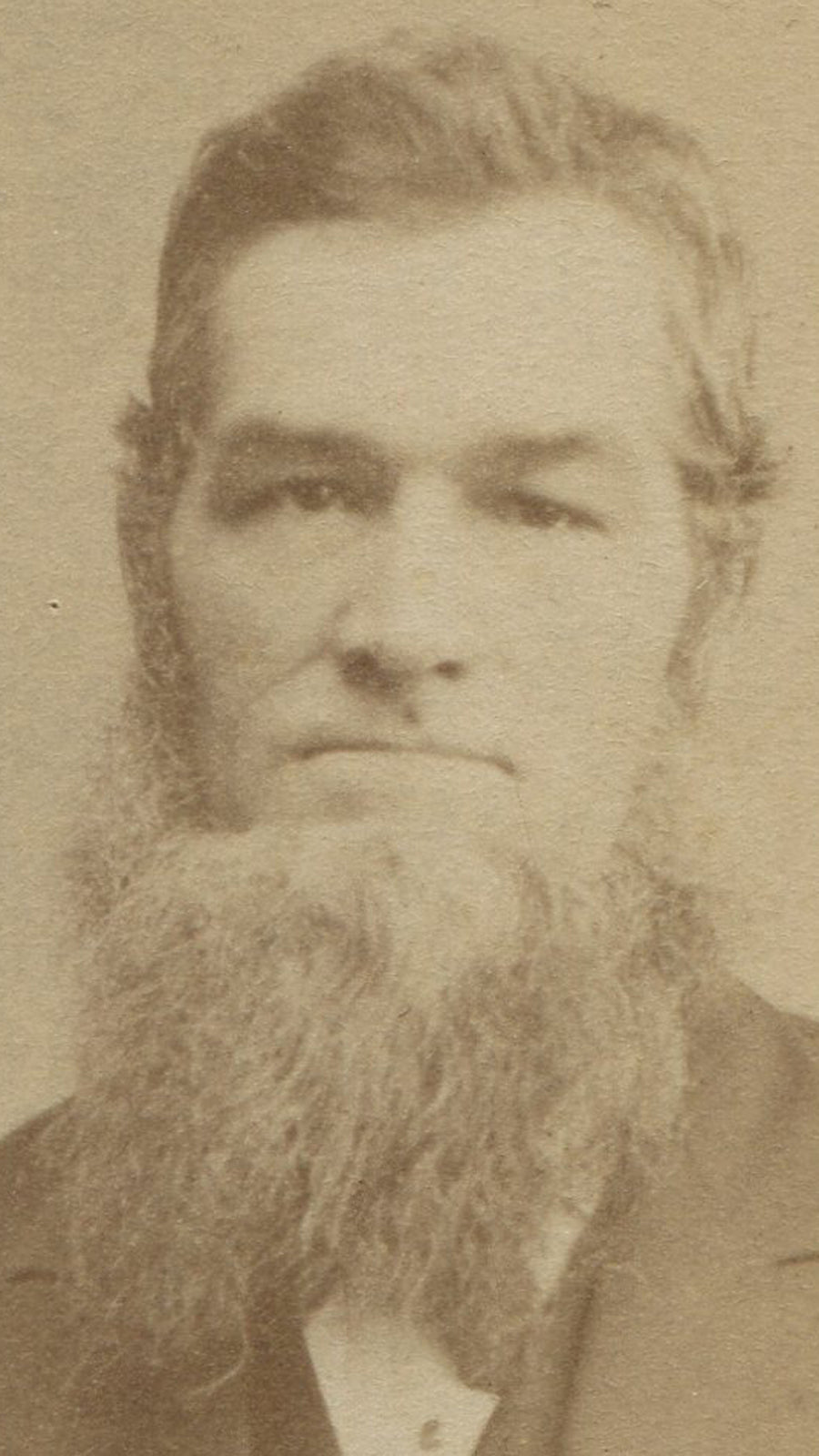 MAN WITH BEARD THAT HAS A LIFE OF ITS OWN. ITS ALIVE. CDV.