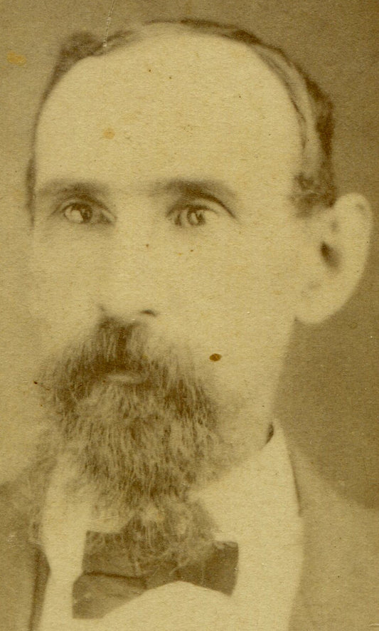 RAT FACED MAN W/ SCRAGGLY BEARD. CDV.