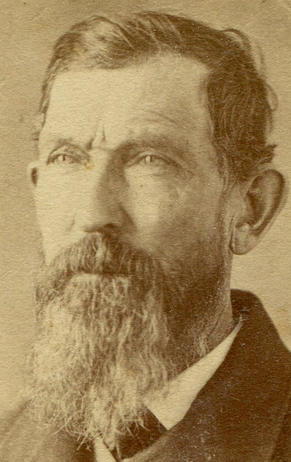 BEARDED MAN W/SQUINTING EYES. CDV.