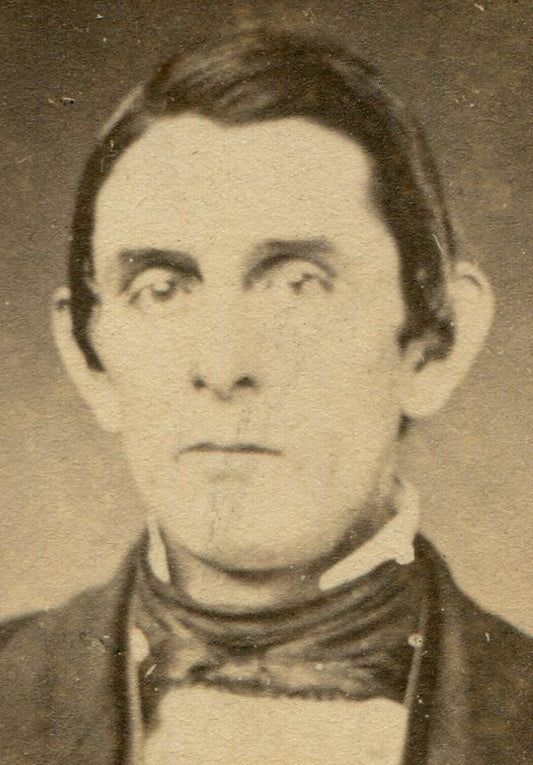 MAN WITH BIG EARS. EARLY CDV, TWO SET. NEW BRUNSWICK, N.J.