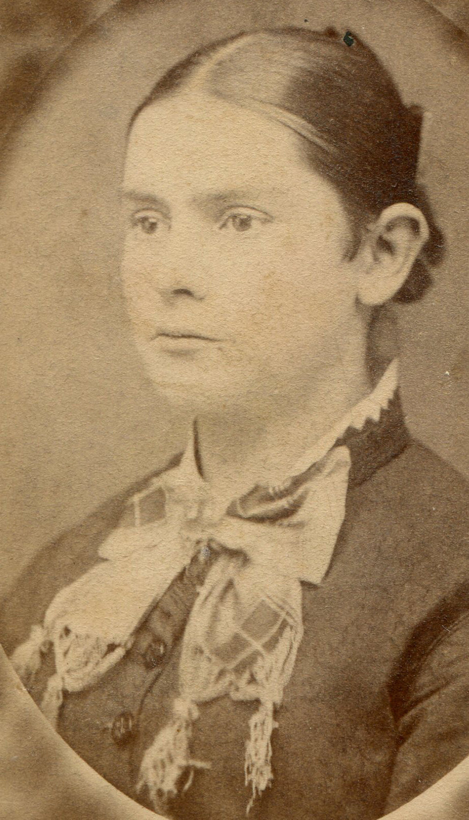 YOUNG WOMAN, BLANK STARE.  CDV, ODD BACKGROUND.