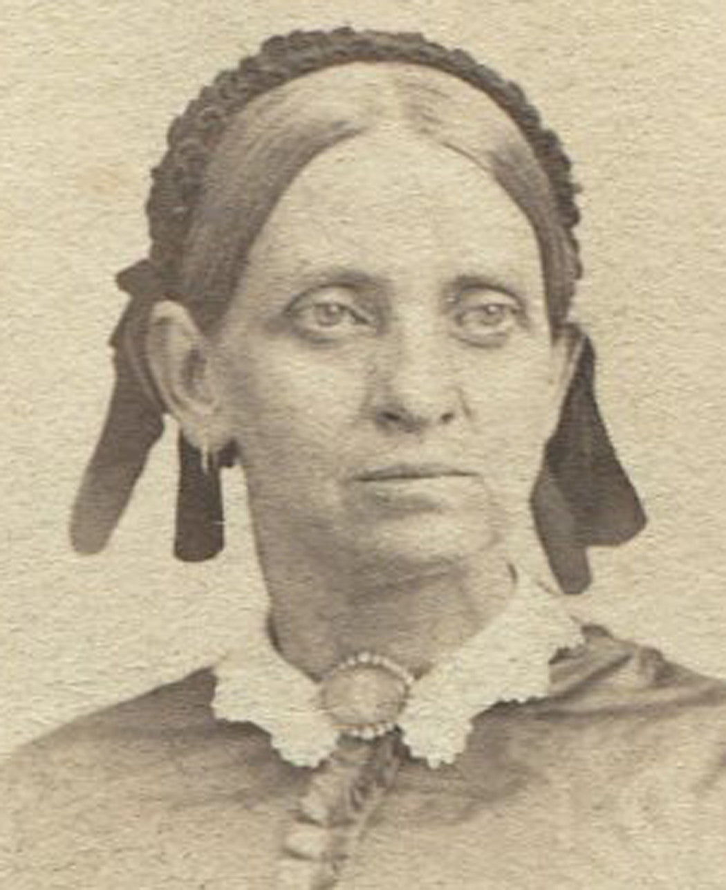 HEAVY EYED WOMAN WEARING BONNET. CDV.