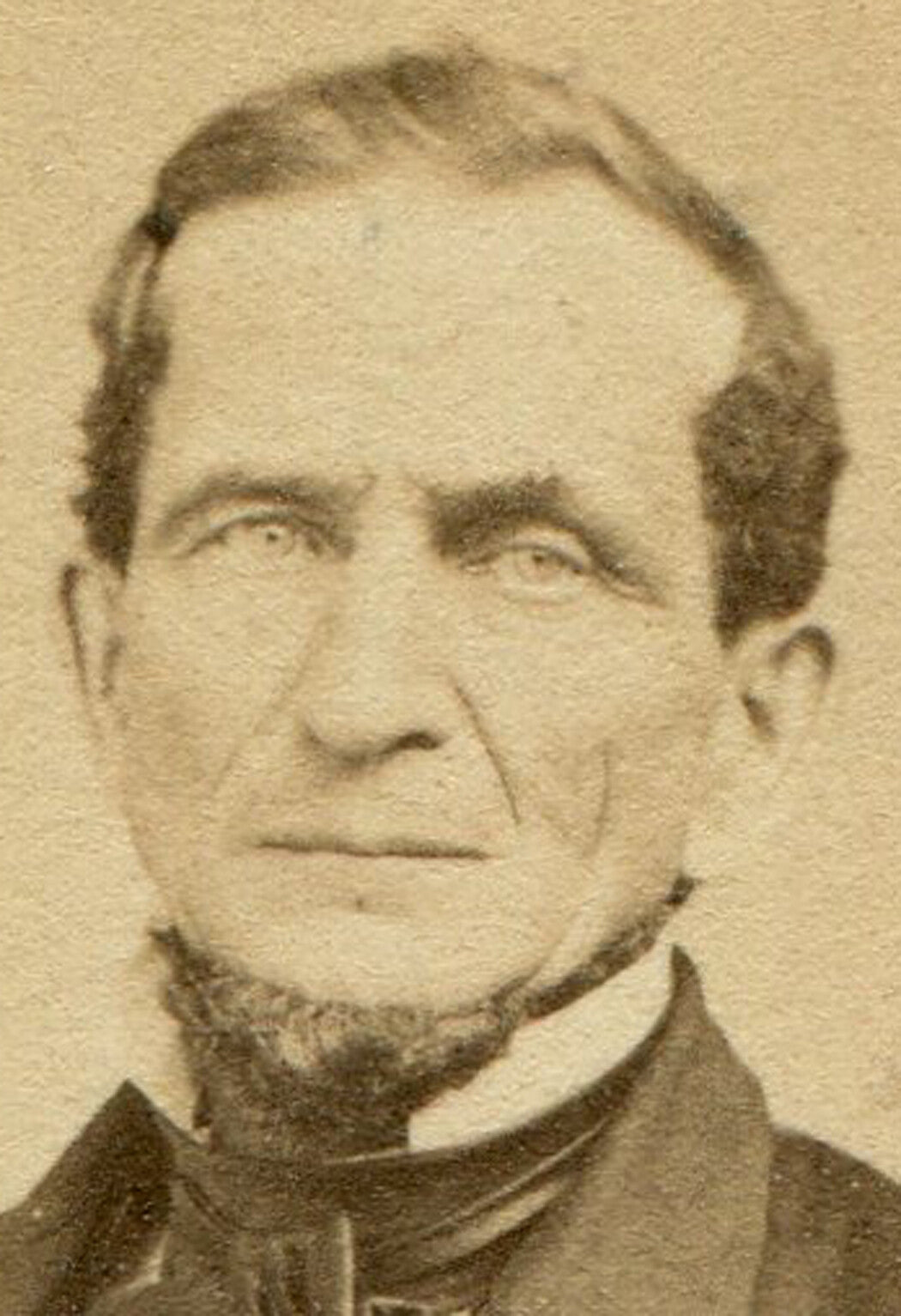 FINELY DRESSED MAN WITH UNDER CHIN BEARD. CIVIL WAR ERA CDV. LYNN, MASS.