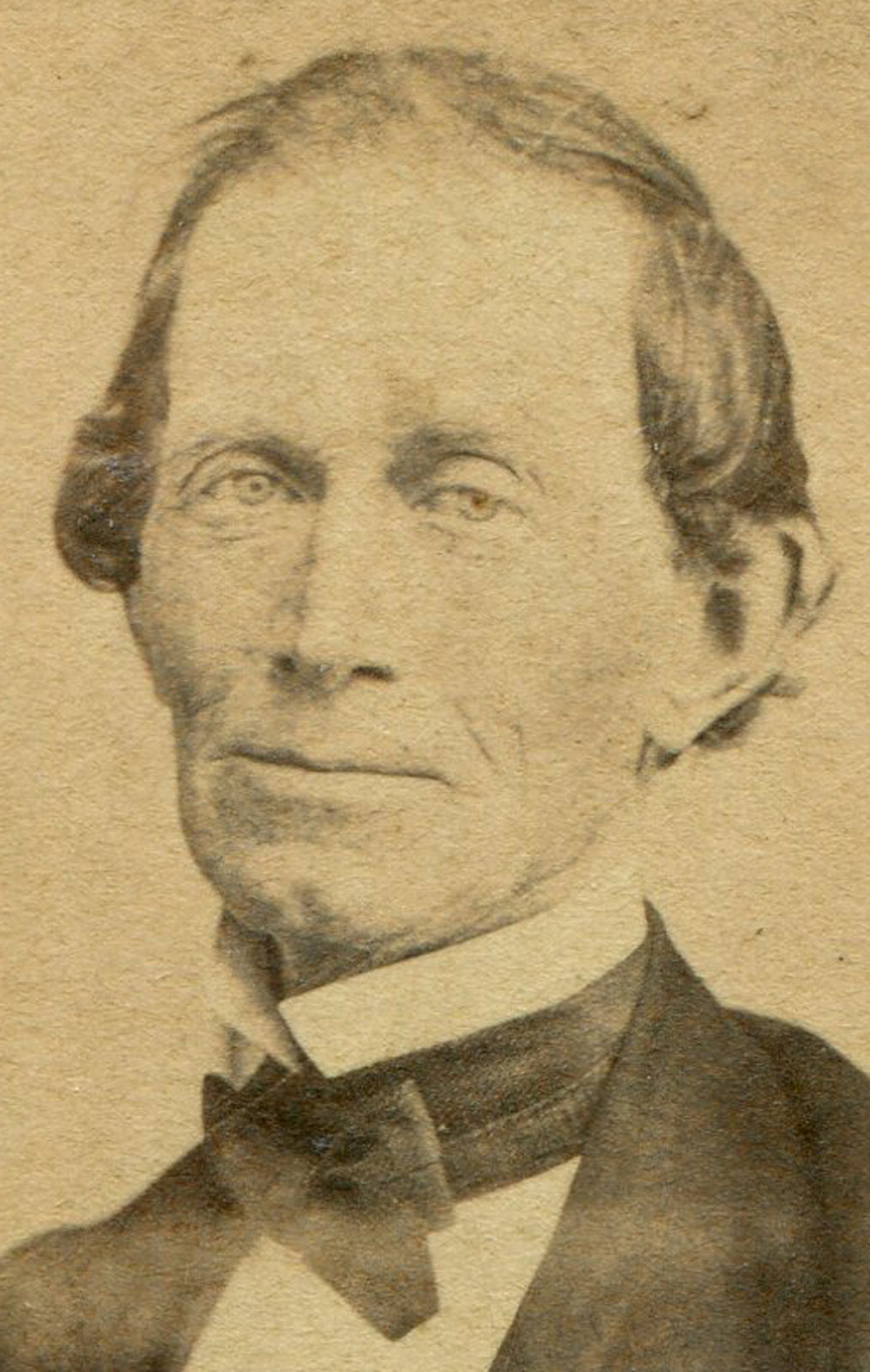 MAN, CLEFT CHIN, WEARY EXPRESSION. CDV.