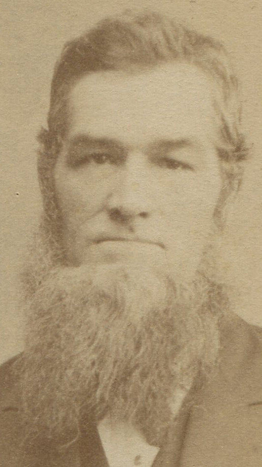 MAN WITH BEARD THAT HAS A LIFE OF ITS OWN. ITS ALIVE. CDV.