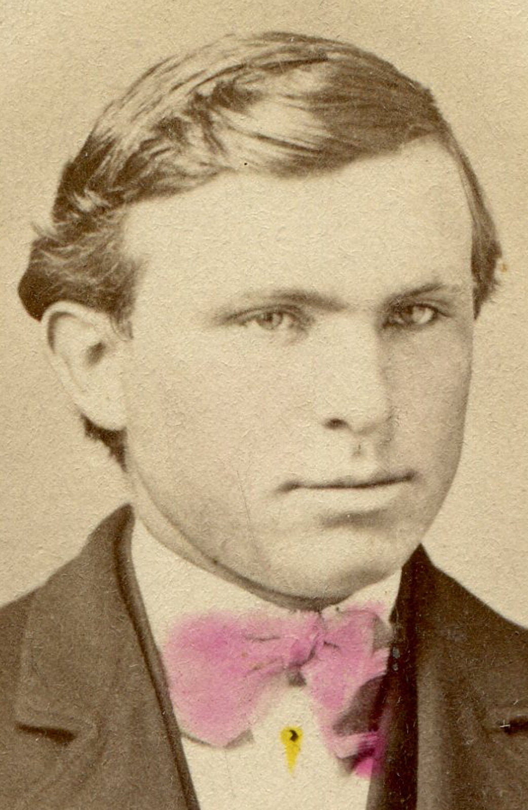 MAN WITH FURROWED BROW AND PINK TINTED BOW TIE. CDV, ALLEGHENY, PA.