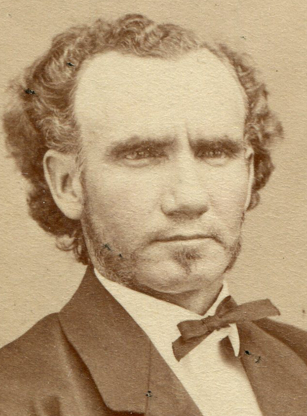 SQUINTING MAN WITH WAVY HAIR. GET HIM SOME GLASSES. CDV.