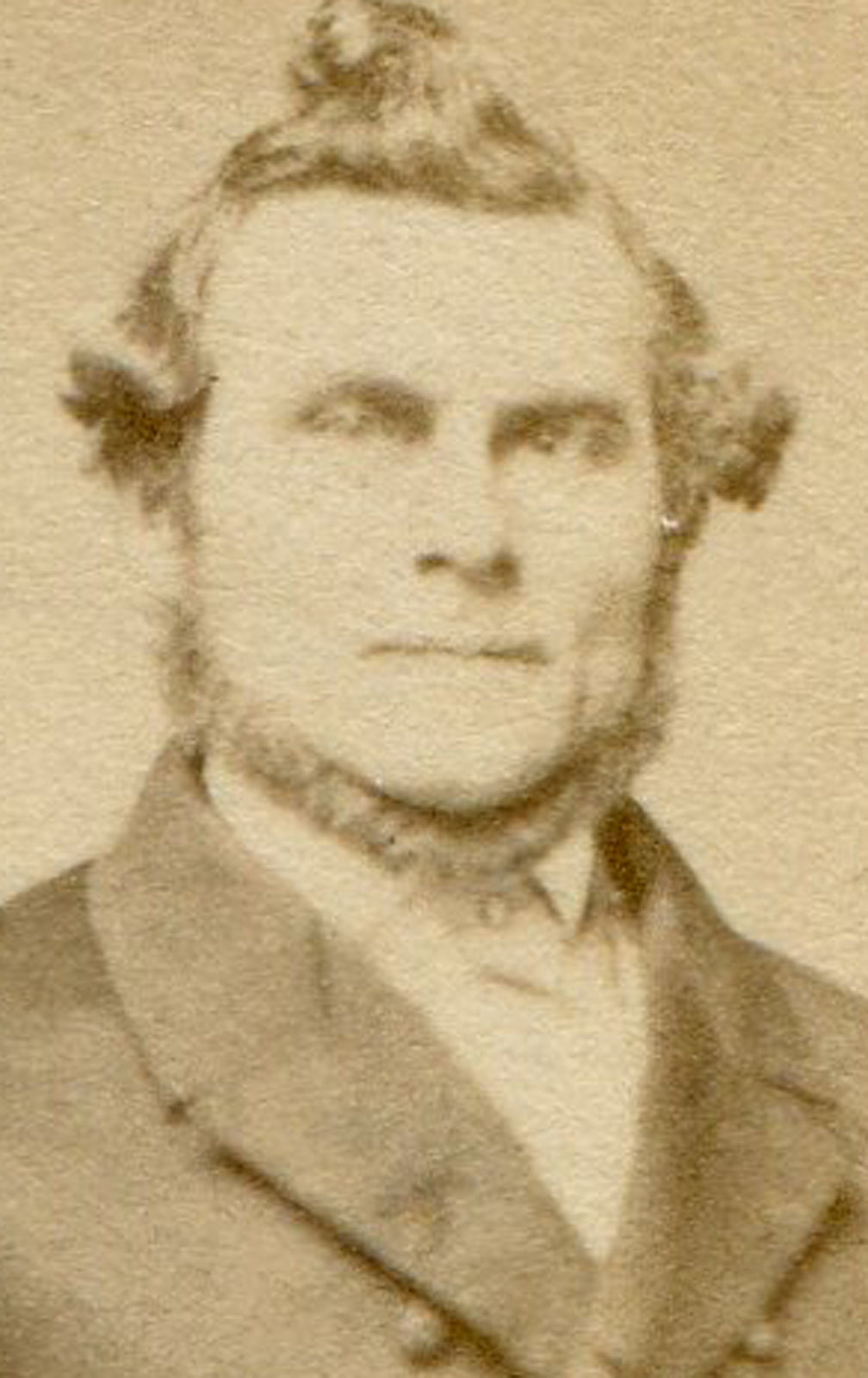 BEARDED MAN WITH CUPIE DOLL HAIR, NAPOLEON POSE HOLDING TOP HAT. CDV.