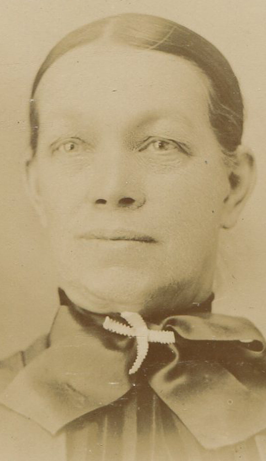 WOMAN WITH PAINFULLY TIGHT HAIR BUN. CABINET CARD.