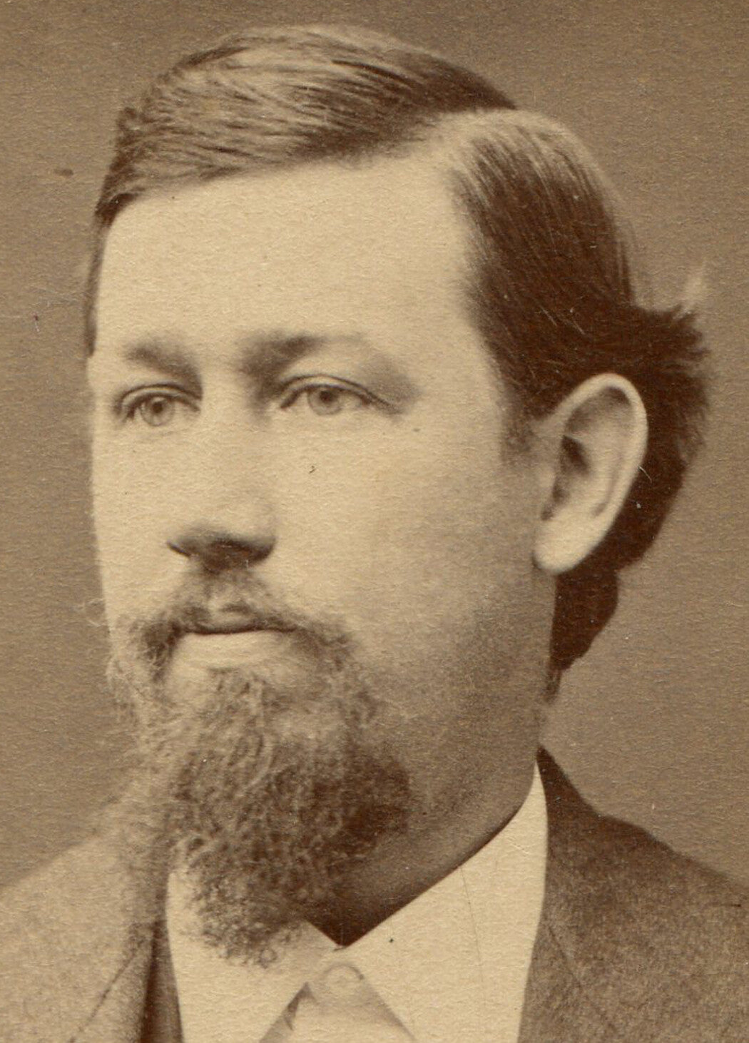 MAN WITH BEARD AND HAIR FLIP BEHIND EAR. CDV. ADAMS, MASS.