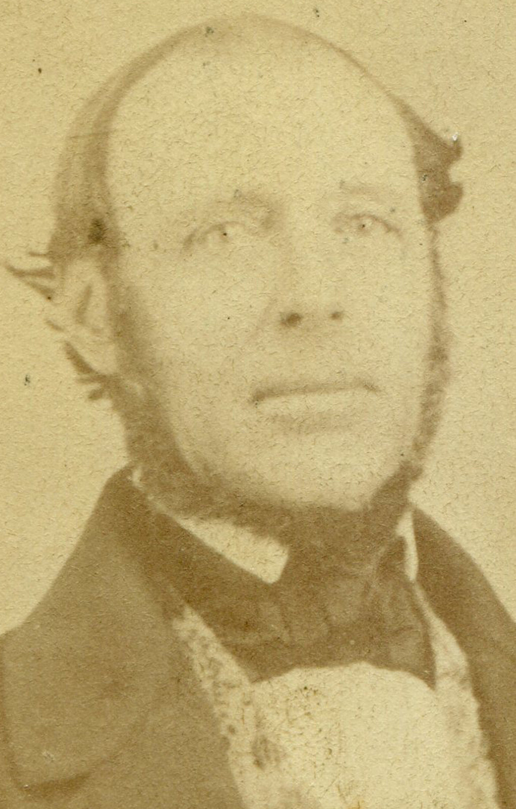 BALDING MAN W/UNDER CHIN BEARD. CDV.