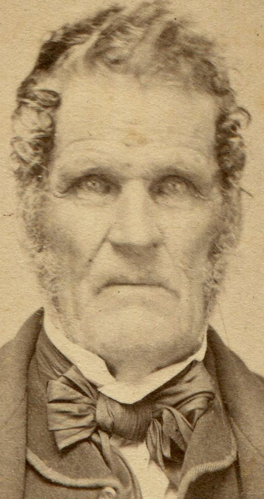 MAN WITH A HUMAN FACE CARVED OF STONE. STUNNING CDV. STOWE, VT.