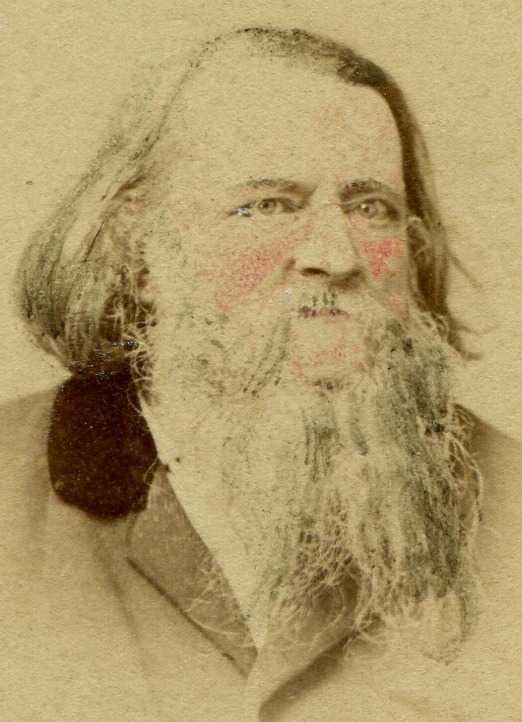 MAN W/LONG UNATTRACTIVE BEARD, THIN LONG HAIR. TINTED CDV. N.Y.
