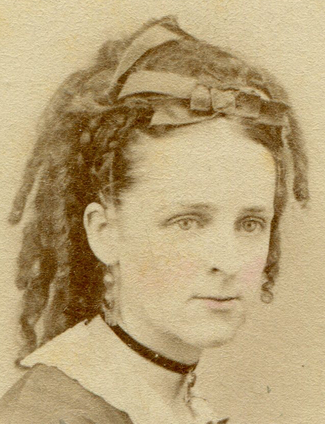 WHITE WOMAN W/ DREADLOCKS, 1860-70. TINTED CDV.