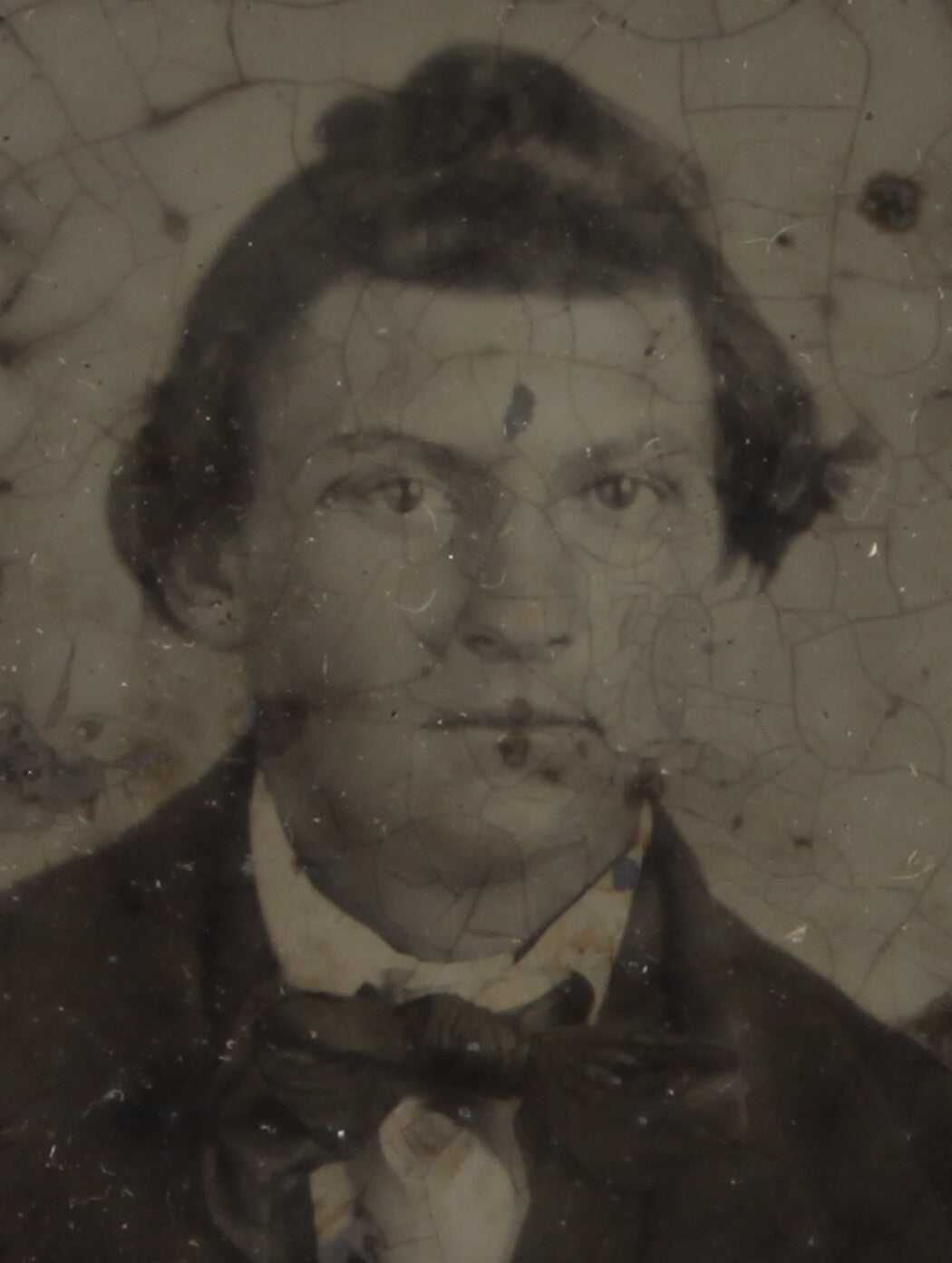 Antique Ambrotype Portrait – 6th Plate, Man With Very Large Hand On Lapel