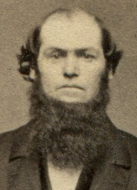 THICKLY BEARDED MAN IN WAIST COAT. CDV. SPRINGFIELD, MASS.