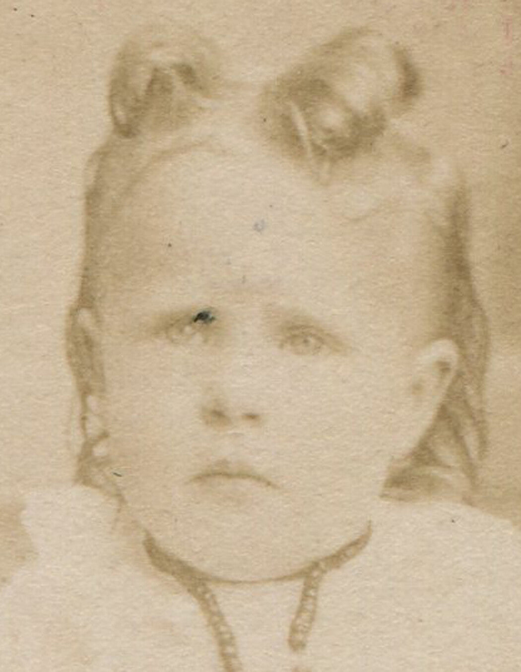 TODDLERS, VERY GRUMPY, SUSPICIOUS EXPRESSIONS. CDV 3 SET.