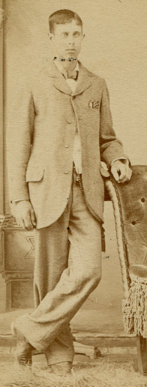 TALL THIN MAN WITH BUG EYES. CDV.