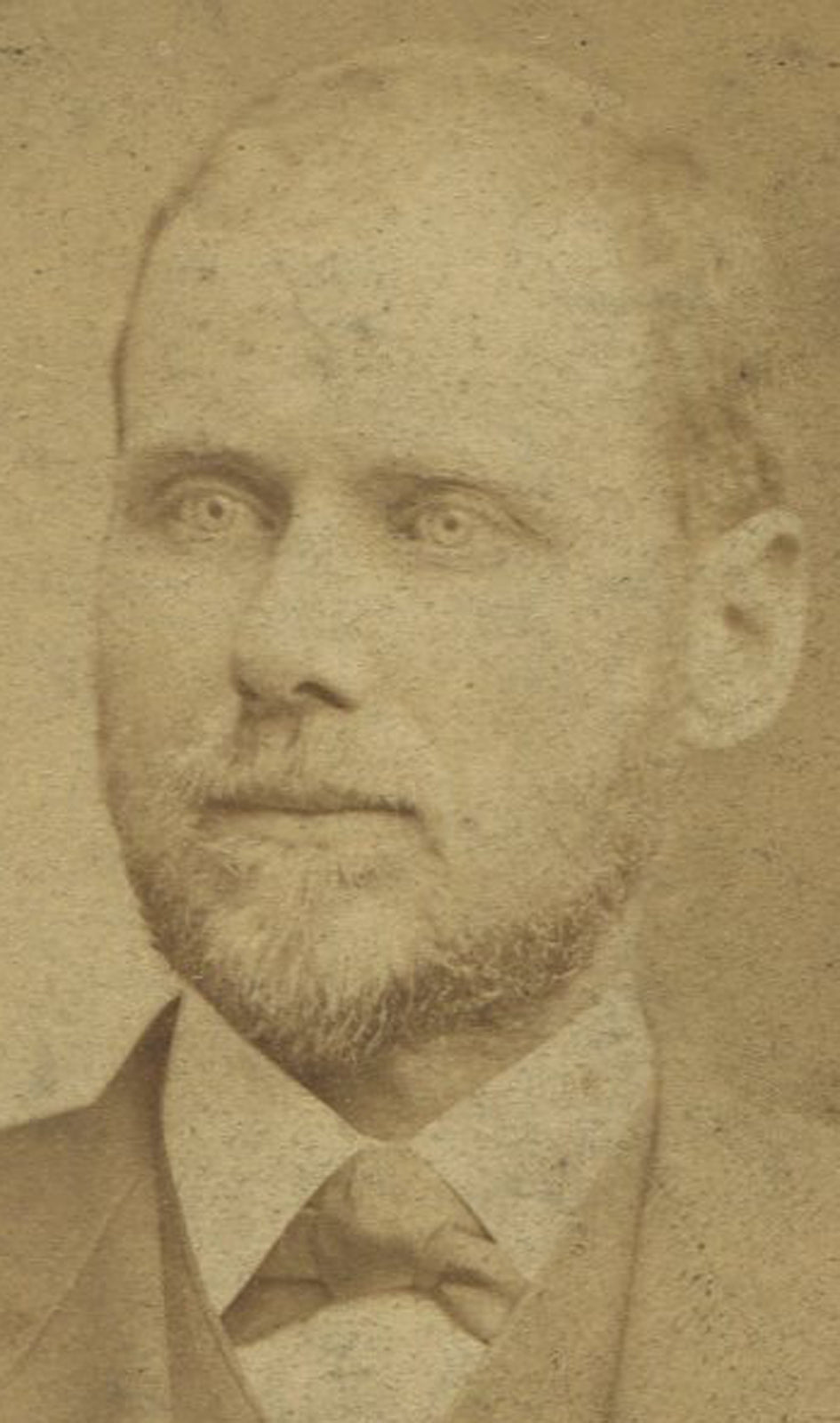 MAN WITH CLOSE BEARD. CDV BY DABB, PITTSBURGH, PA.