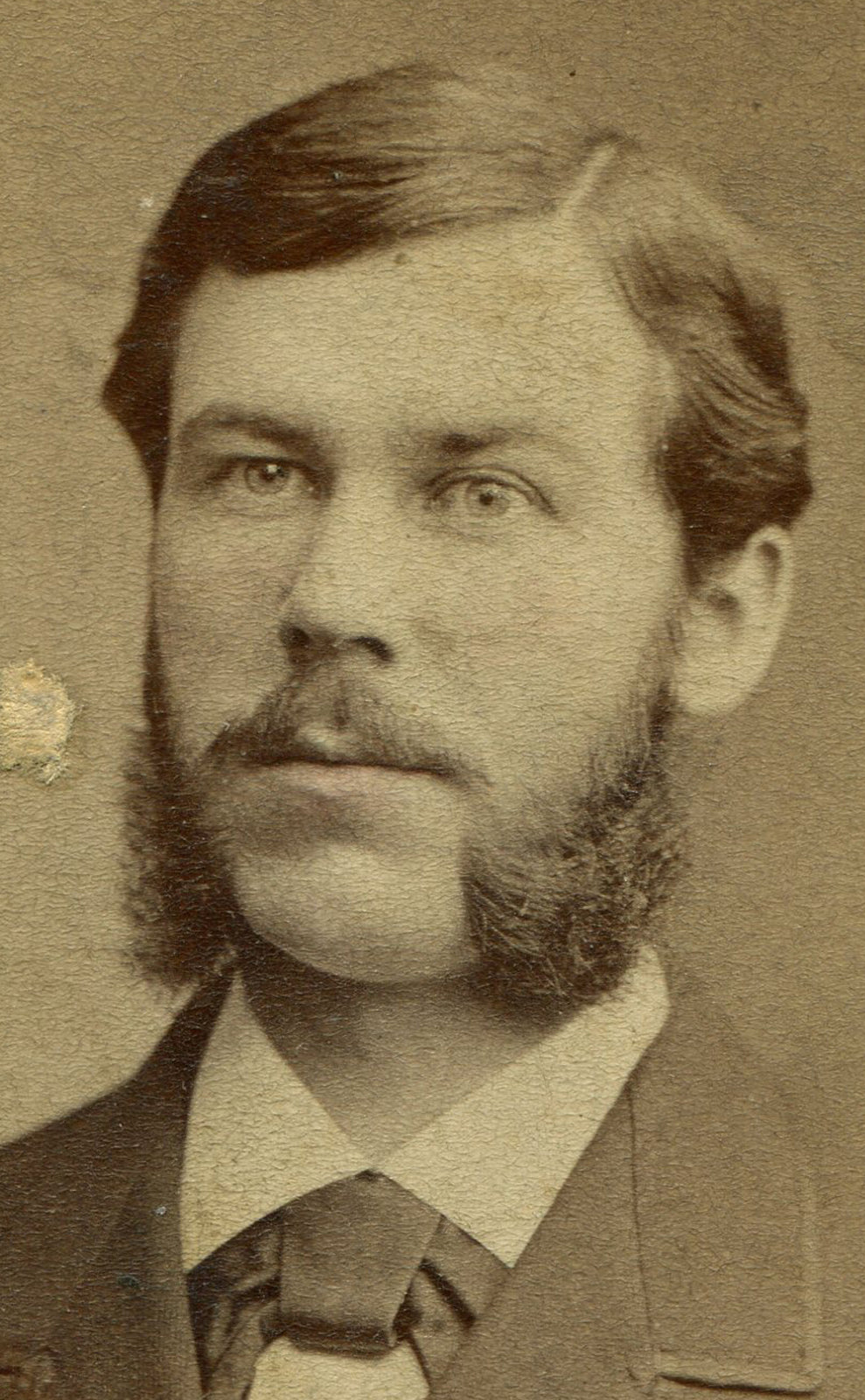MAN W/ BIG MUTTON CHOPS, BIG LAPELS. CDV. PHILADELPHIA, PA.