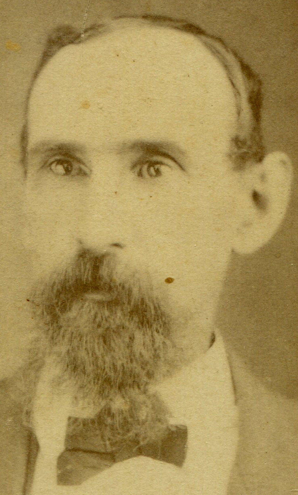 RAT FACED MAN W/ SCRAGGLY BEARD. CDV.