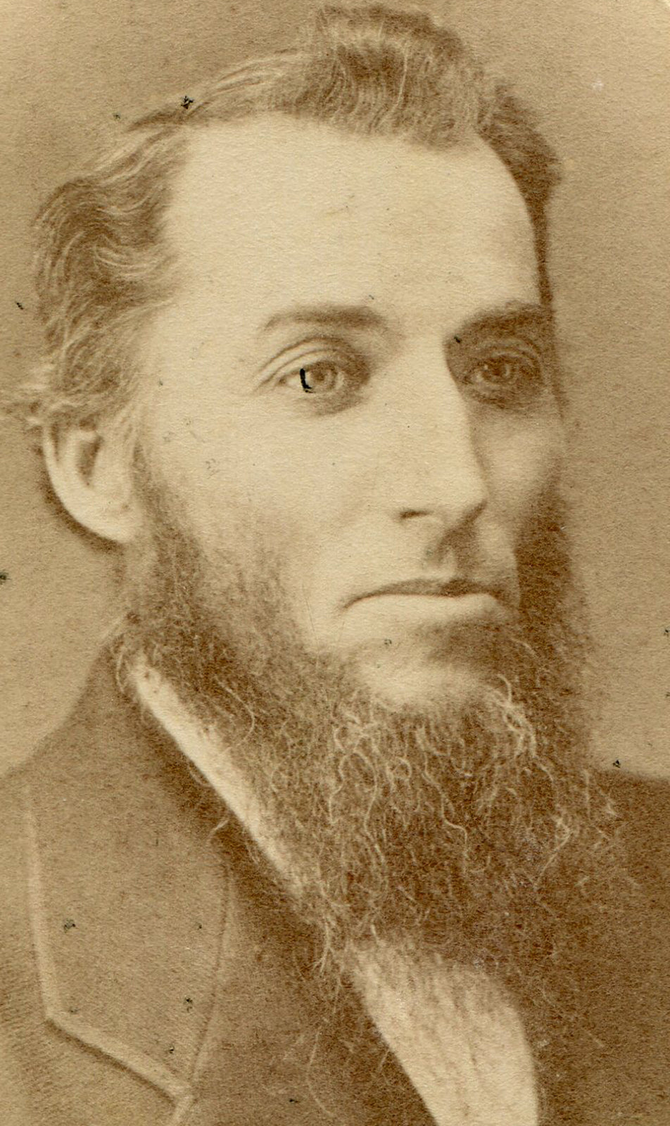 STRONG FEATURED MAN WITH STRAGGLY LINCOLN BEARD. CDV.