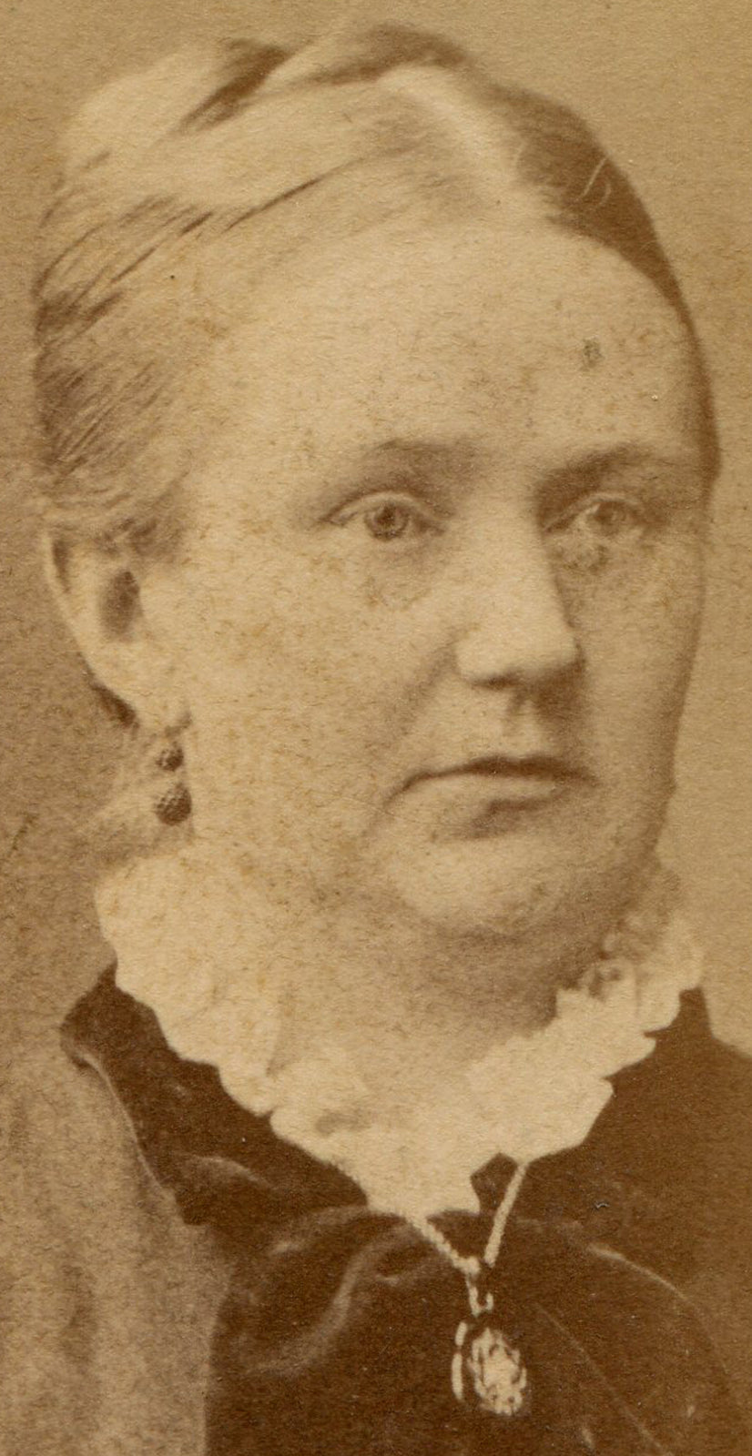PUDGY FACED WOMAN, RUFFLED COLLAR, NECKLACES. CDV. STOCKHOLM, SWEDEN.