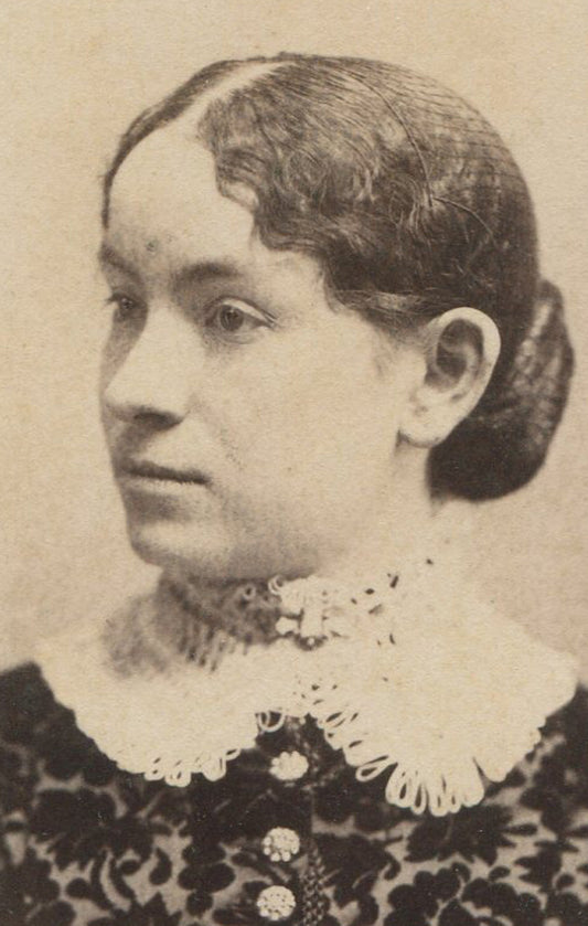 WOMAN W/LARGE FOREHEAD, LACE COLLAR AND DRESS. CABINET CARD. LITTLE FALLS, N.Y.