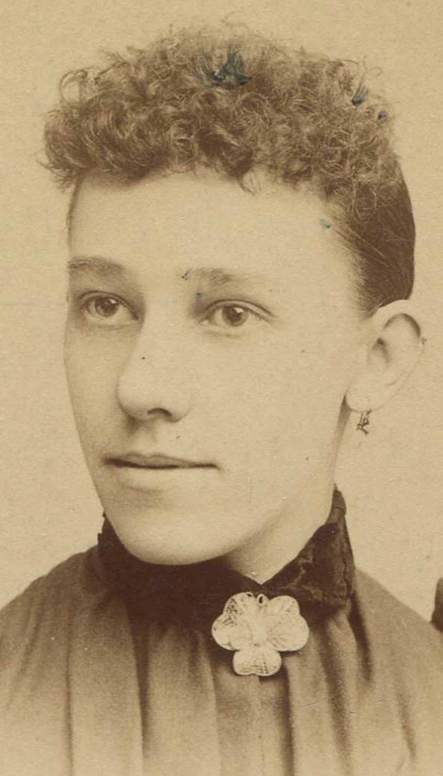 WOMAN, VERY SEVERE CURLY TOP HAIR. UNFORTUNATE. CABINET CARD. SYRACUSE, N.Y.