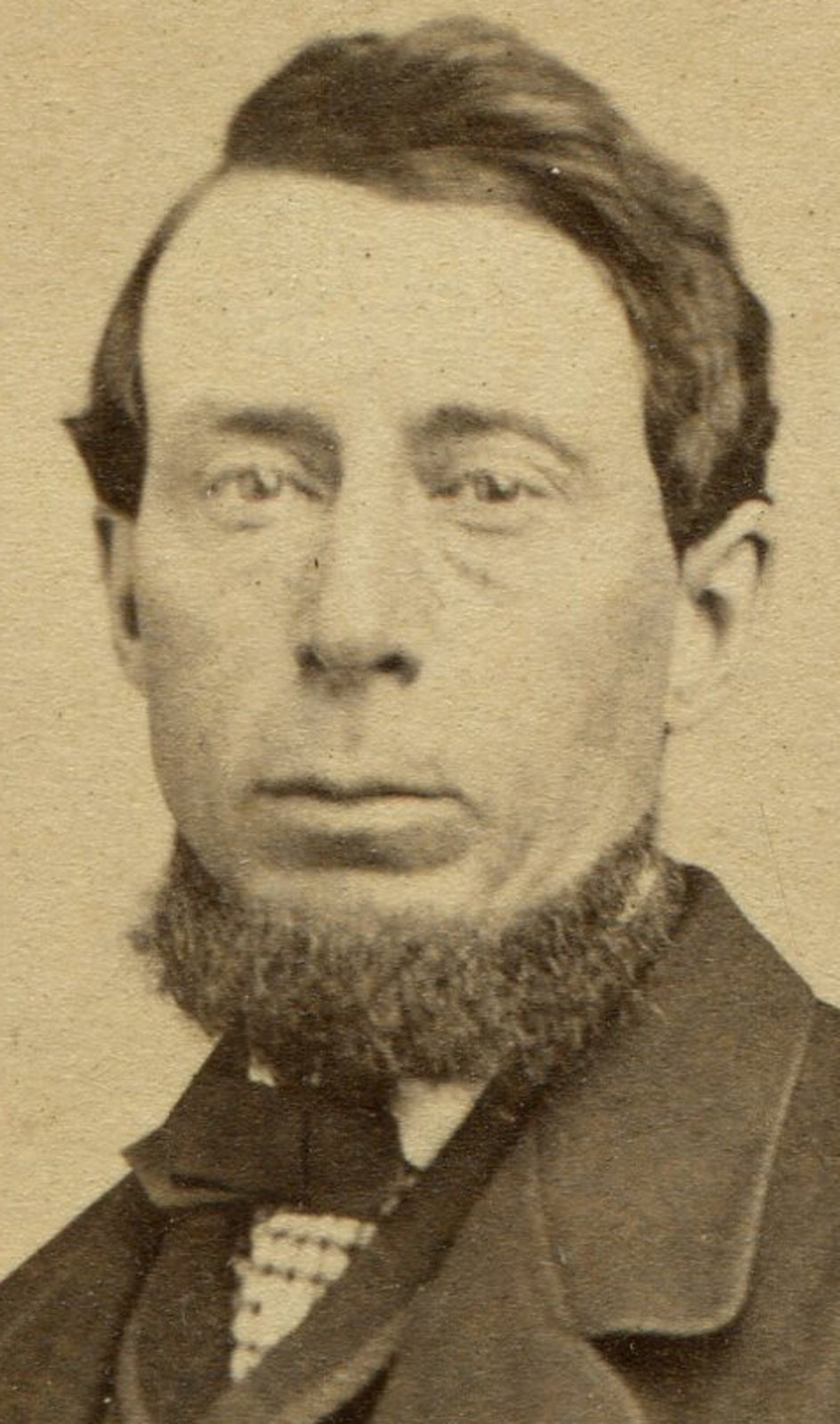 MAN WITH CHIN BEARD AND POCKET SCARF. CDV.  PROVIDENCE, R.I.