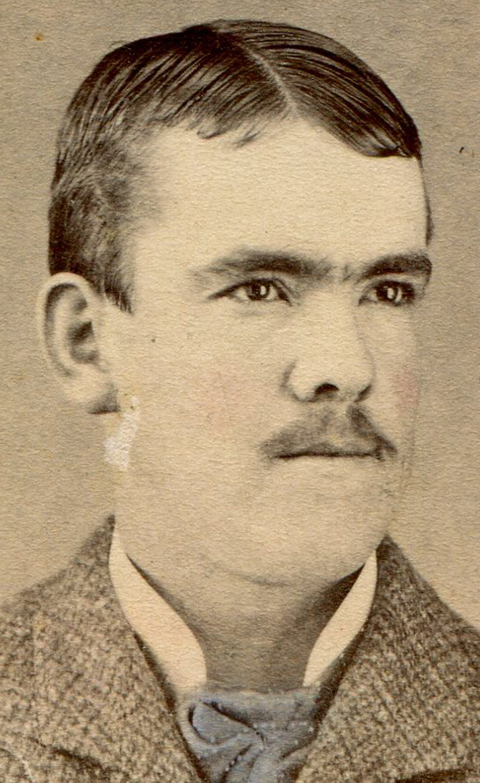 BLOCK HEADED MAN WITH UNIBROW. TINTED CDV. YOUR COUNTY, PA.
