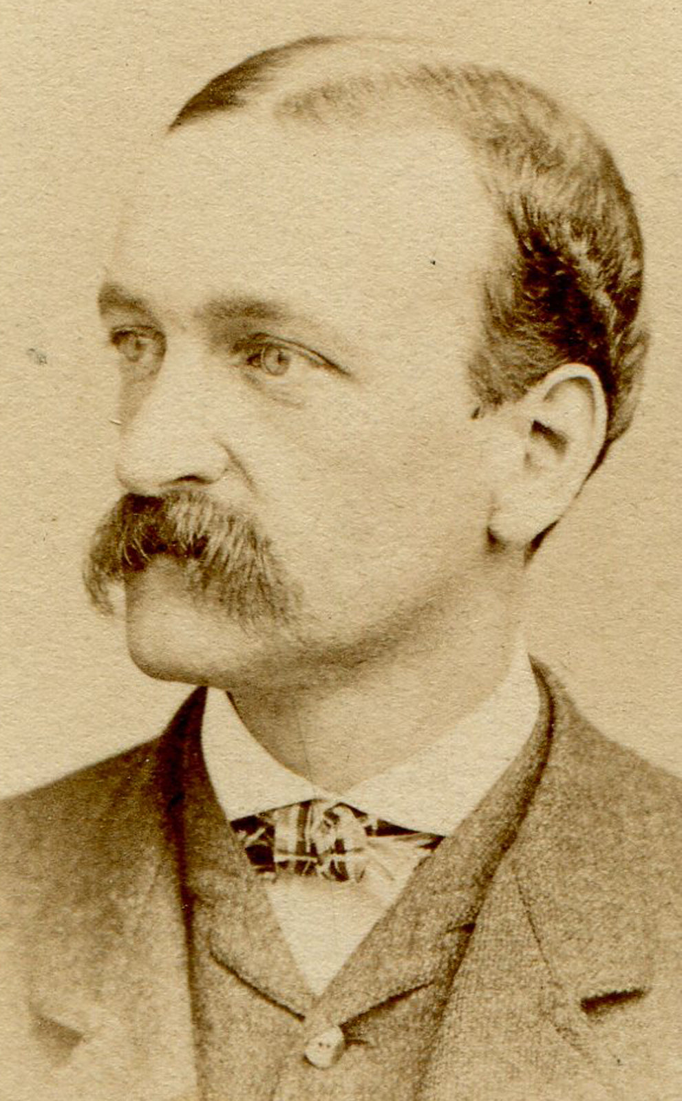 MAN WITH BROOM MUSTACHE AND THINNING HAIR LINE. CDV. PHILADELPHIA, PA.