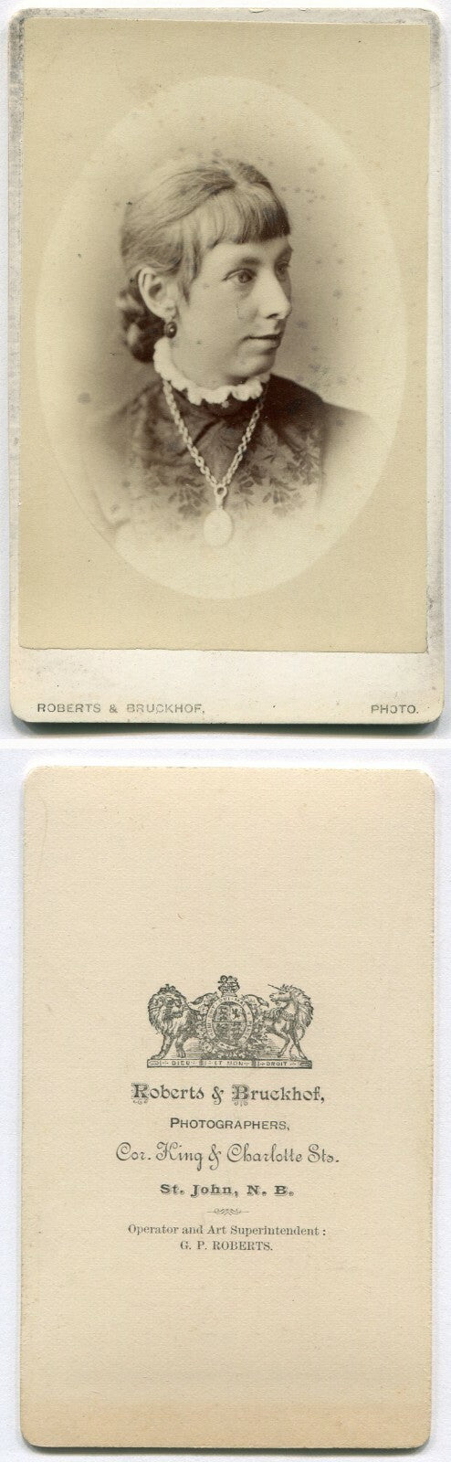 WOMAN W/RECEDING CHIN, NECKLACE. CDV. ST. JOHN, NEW BRUNSWICK, CANADA.