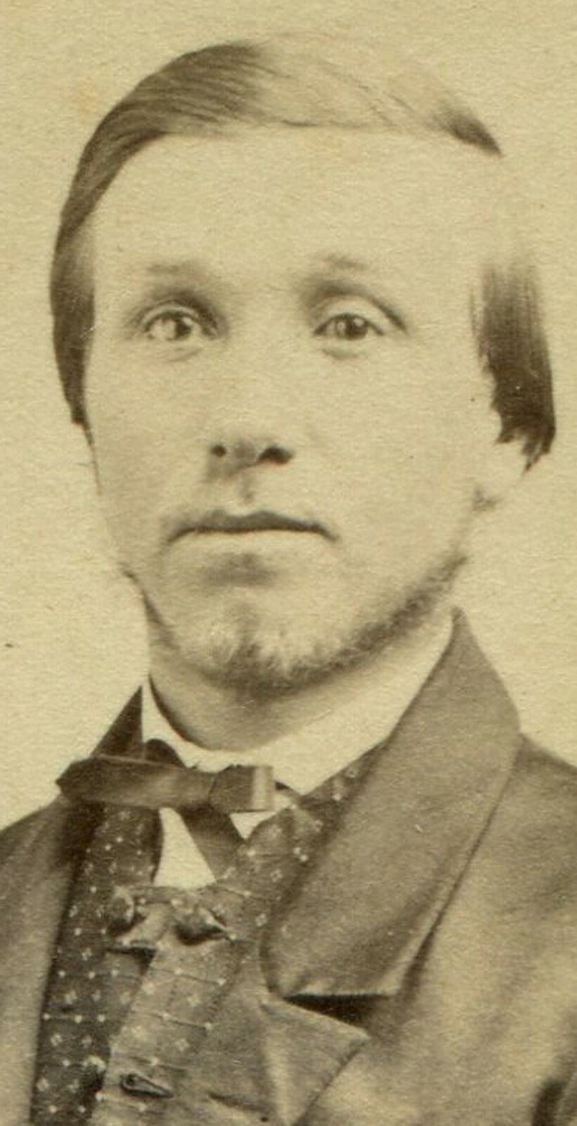 YOUNG MAN W/ A WHISPER OF A BEARD. CDV. ST. JOHN, NEW BRUNSWICK, CANADA.