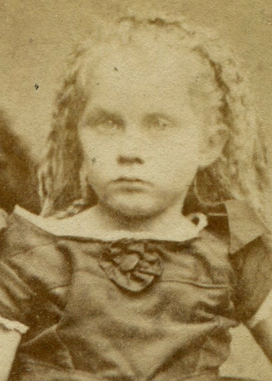 YOUNG GIRL, SEATED POSE/PRETTY DRESS W/BIG BUTTONS. CDV. ST. JOHN, NEW BRUNSWICK