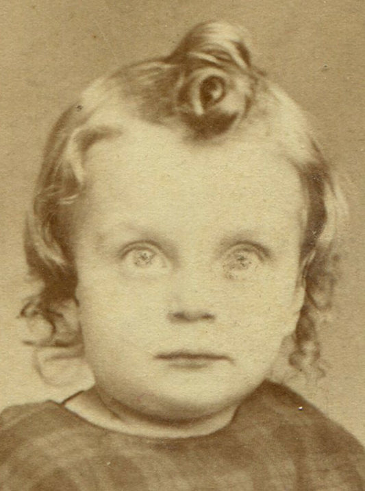 BRIGHT EYED TODDLER WITH KEWPIE DOLL CURL. CDV, BOSCOBEL, WISCONSIN.