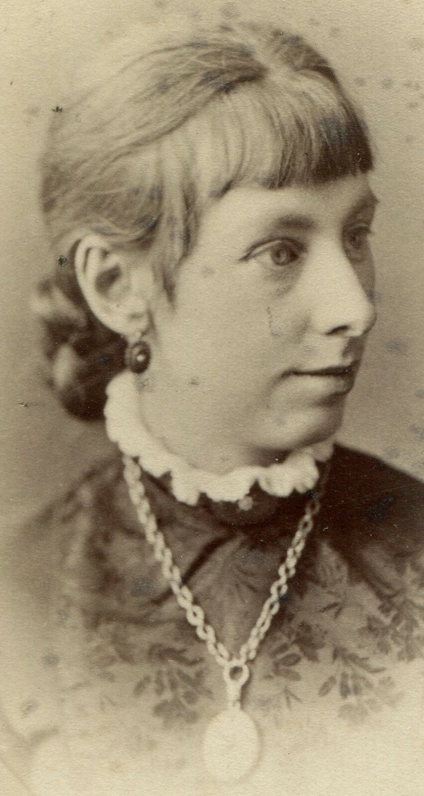 WOMAN W/RECEDING CHIN, NECKLACE. CDV. ST. JOHN, NEW BRUNSWICK, CANADA.