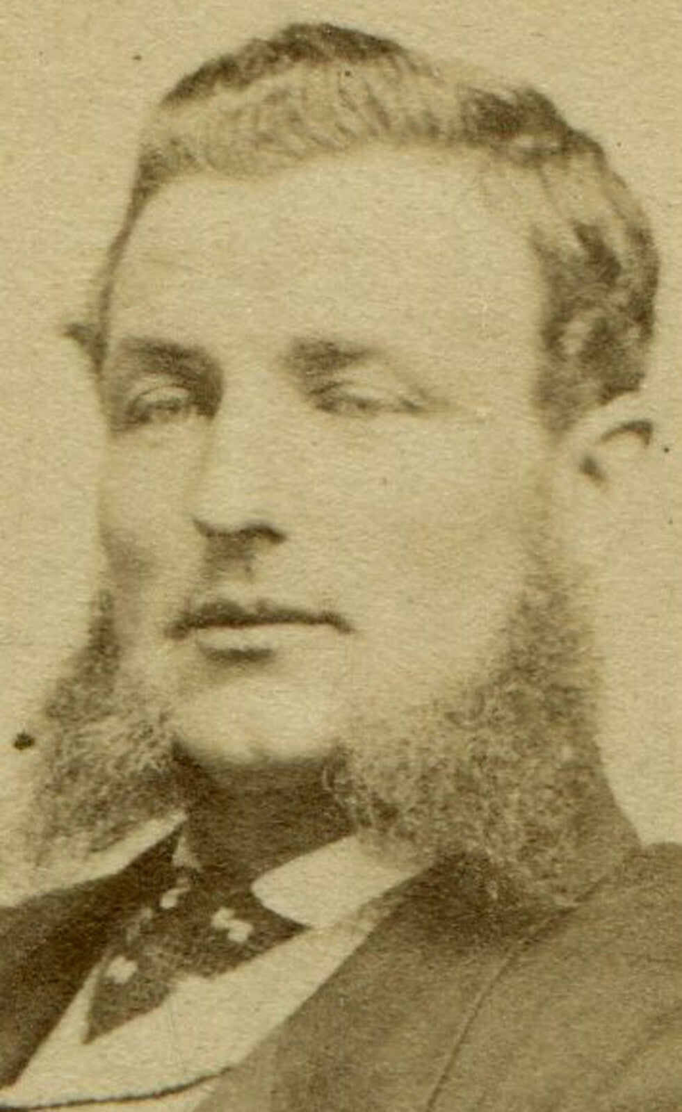 MAN, HALF CLOSED EYES, VERY LONG MUTTON CHOPS. CDV. ST. JOHN, NEW BRUNSWICK, CA.