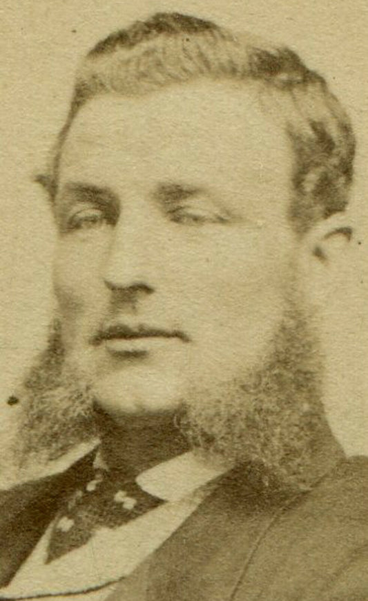 MAN, HALF CLOSED EYES, VERY LONG MUTTON CHOPS. CDV. ST. JOHN, NEW BRUNSWICK, CA.