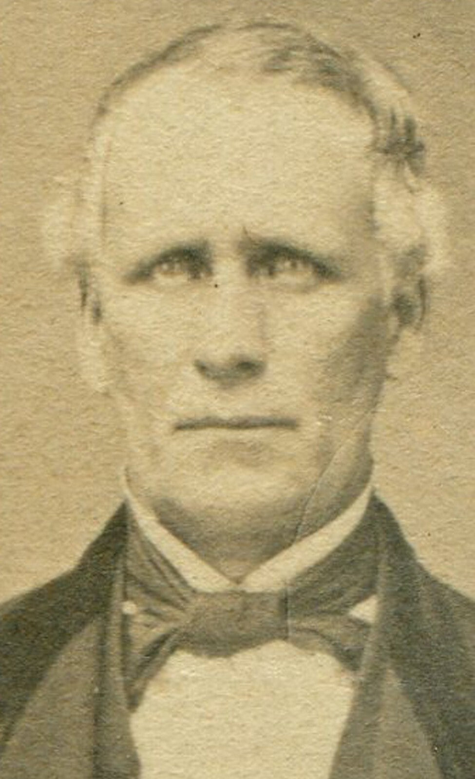 WORRIED OLD MAN, STANDING POSE. EARLY CDV.