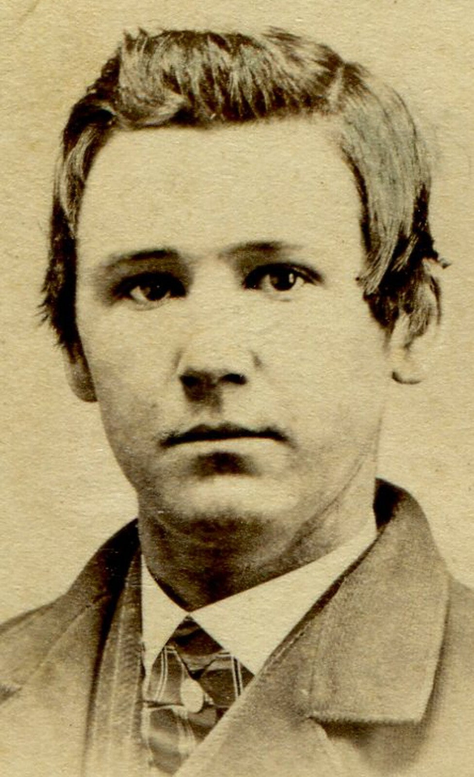 PUDDY FACED YOUNG MAN, THICK HAIR. CDV. TROY, N.Y.