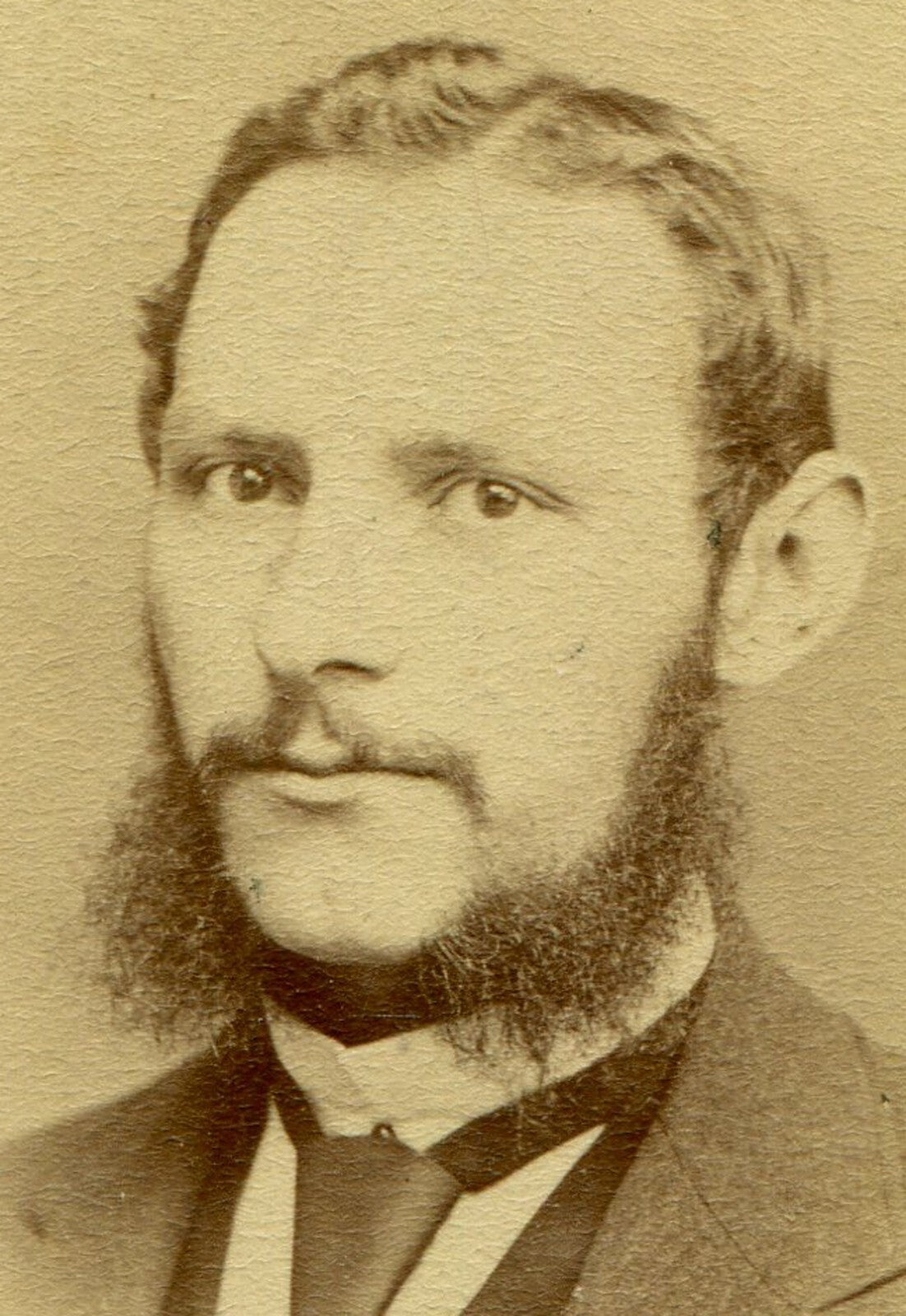 MAN W/SHAGGY WHISKERS AND SAD EYES. CDV.