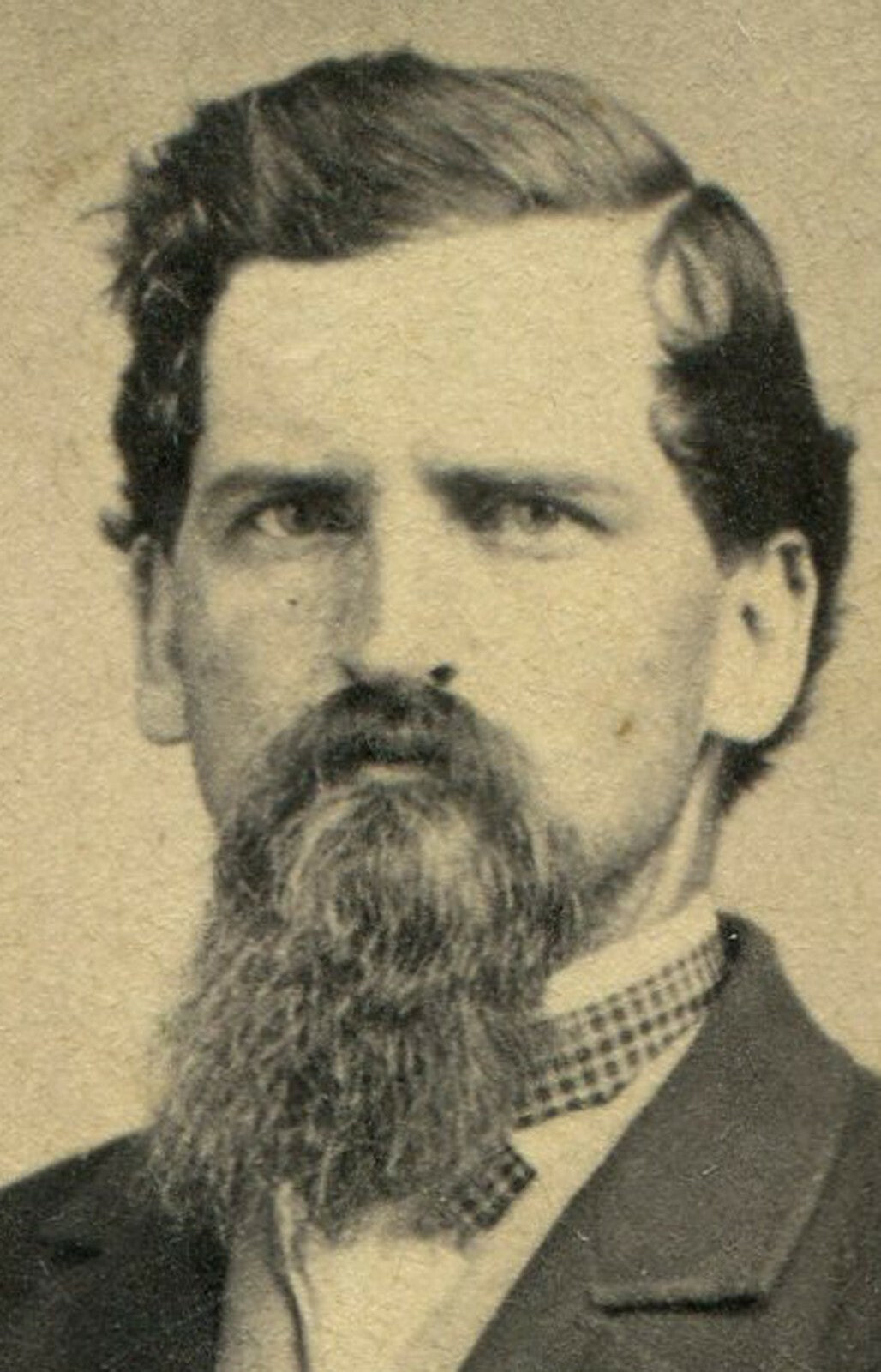 MAN, ANGRY THAT HIS BEARD LOOKS BAD. CDV. HOOSICK FALLS, N.Y.