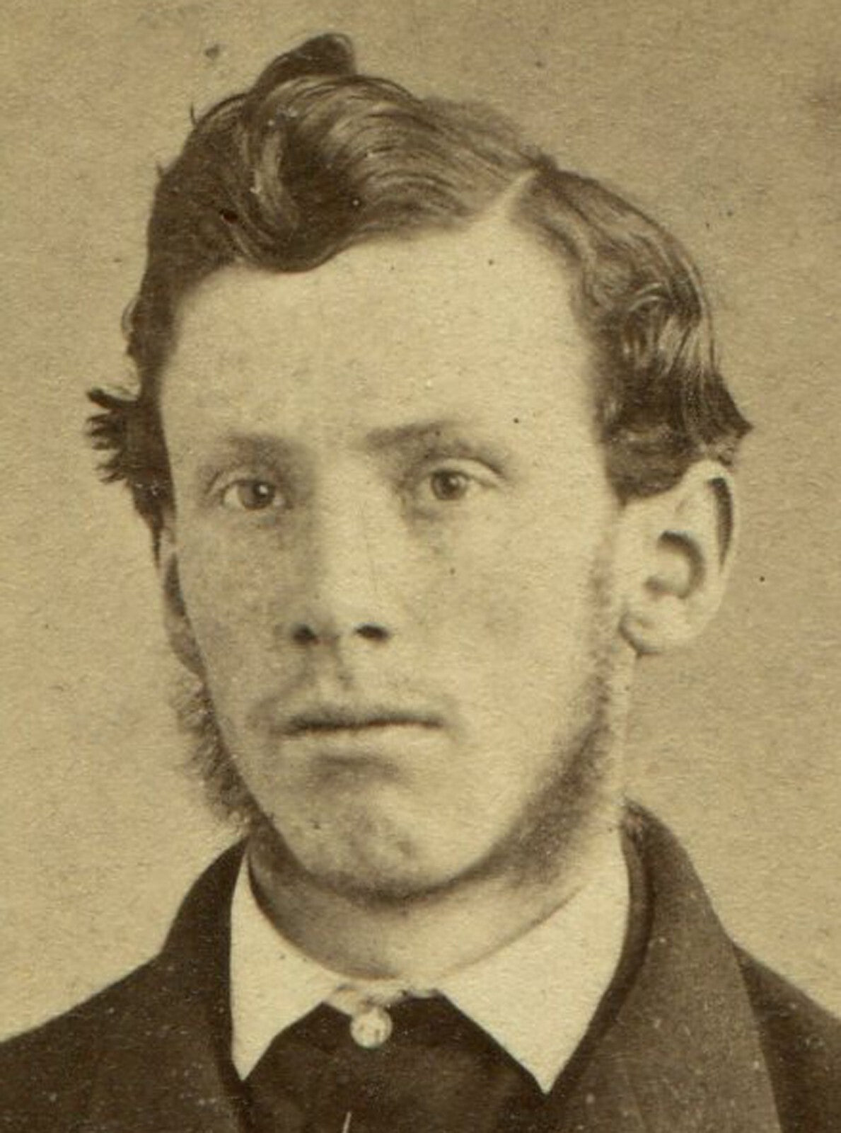 MAN W/MUTTON CHOP SIDEBURNS AND CUPIE DOLL HAIR. CDV. PARIS.